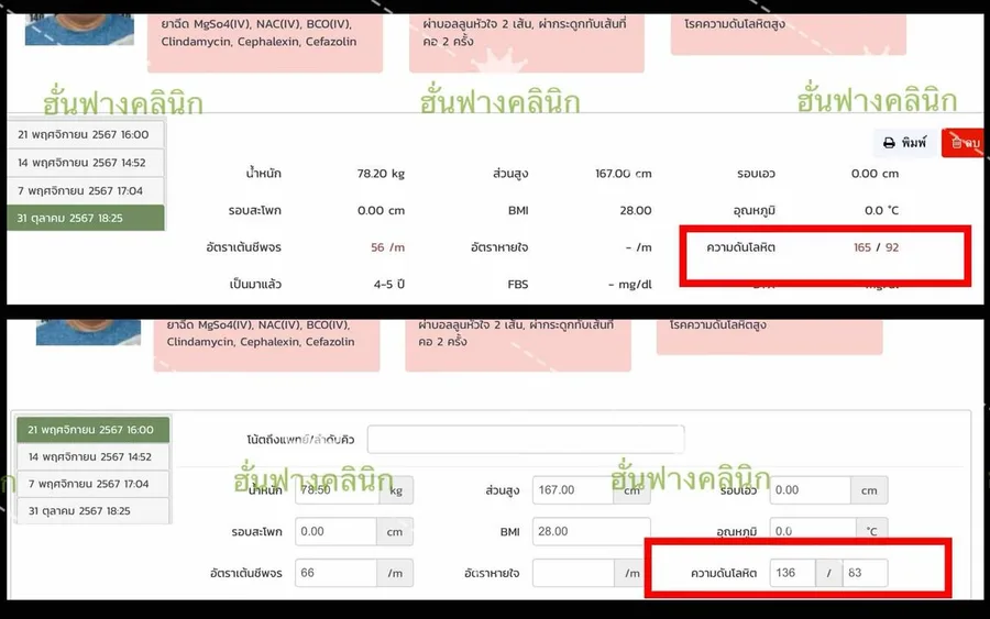 บันทึกคลินิกความดันแรกเข้า 165/92 หลังดูแลต่อเนื่อง 136/83