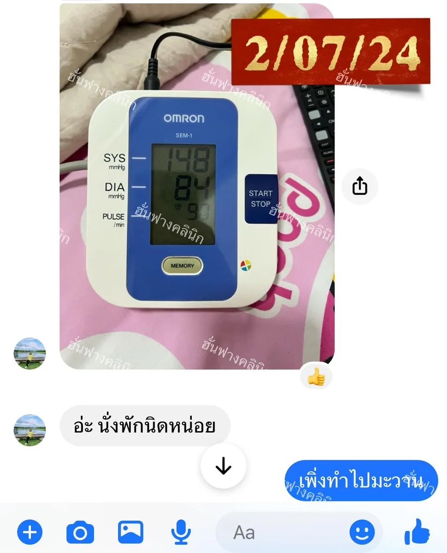 คนไข้ส่งค่าความดัน 148/84 หลังฝังเข็มวันที่สอง