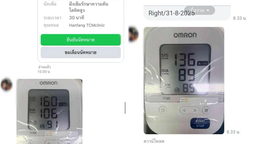 ตัวอย่างการนัดติดตามอาการพร้อมบันทึกค่าความดัน