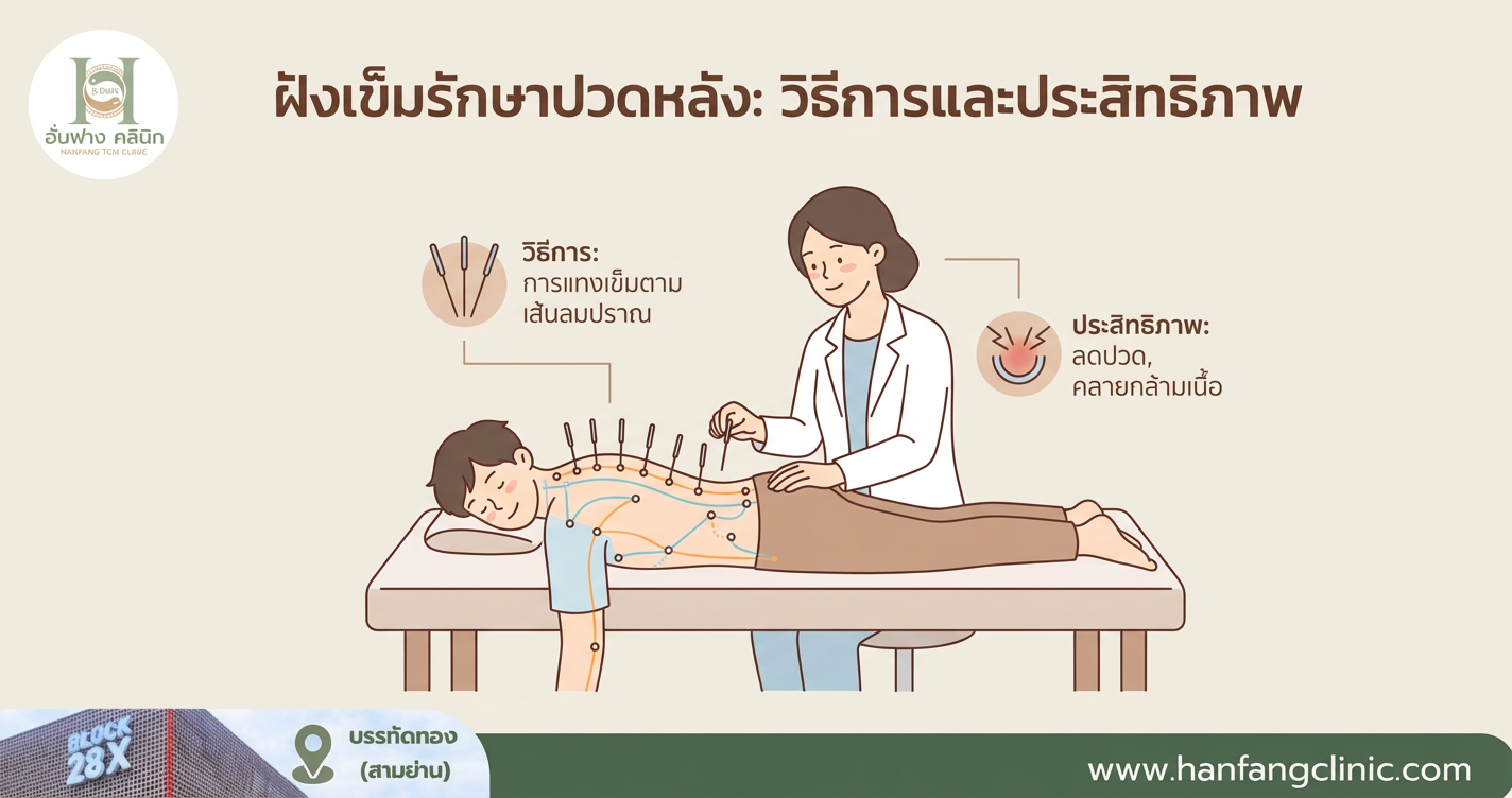 ฝังเข็มรักษาปวดหลัง: วิธีการและประสิทธิภาพ