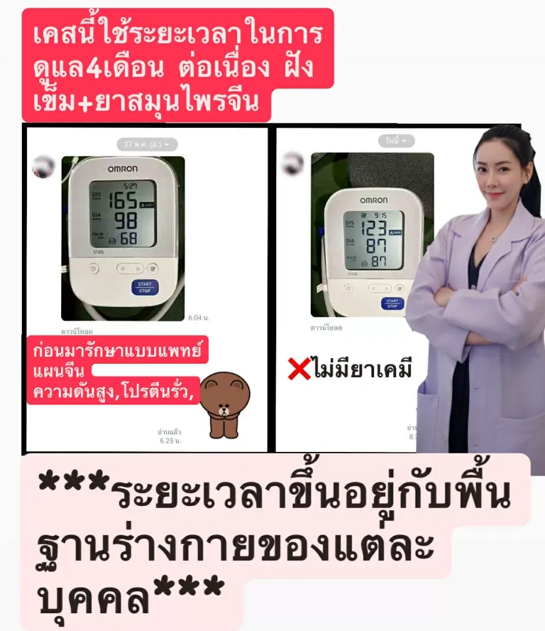 เคสรักษาความดันสูงด้วยฝังเข็มและสมุนไพรจีน